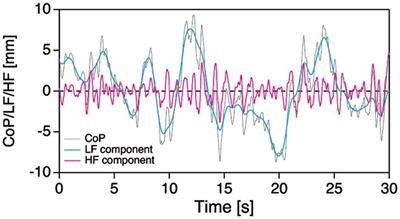 Age-related changes in static balance in older women aged in their early sixties to their late eighties: different aging patterns in the anterior–posterior and mediolateral directions